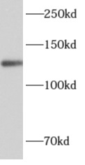      anti- ALG13 antibody