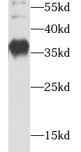      anti- AIP/ARA9 antibody