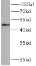      anti- ALG1 antibody