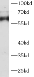      anti- AGFG1 antibody