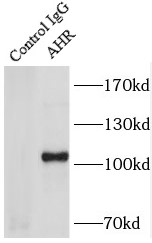      anti- AHR antibody