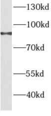      anti- AGGF1 antibody