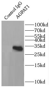      anti- AGPAT1 antibody