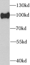      anti- AGO2 antibody