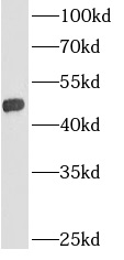      anti- AGPAT9 antibody