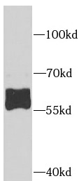      anti- AHCYL1 antibody