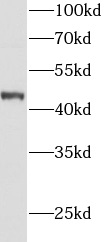      anti- AGXT antibody