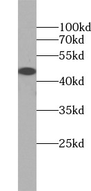      anti- AGTR1 antibody