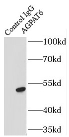      anti- AGPAT6 antibody