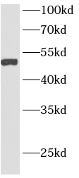      anti- AGPAT6 antibody