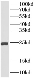      anti- AGR3 antibody