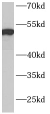      anti- ADPGK antibody