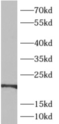      anti- ADI1 antibody