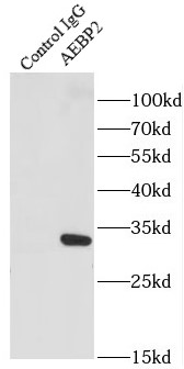 AEBP2抗体