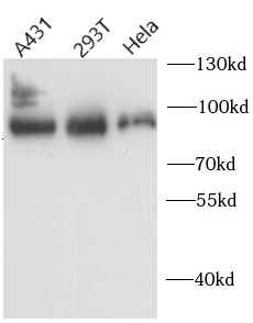      anti- AFM antibody