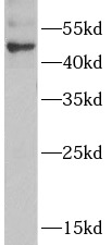      anti- ADSS antibody