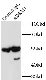      anti- ADRM1 antibody