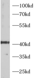      anti- ADRM1 antibody