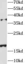      anti- AGA antibody