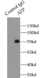      anti- AFP antibody