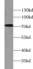      anti- AFP antibody