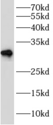      anti- AFMID antibody