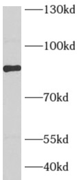      anti- AFG3L2 antibody