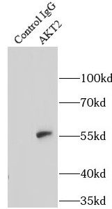      anti- AKT2 antibody