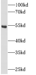      anti- AKT2 antibody