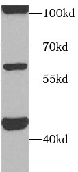      anti- ACVR1C antibody