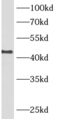      anti- ADH7 antibody