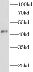      anti- ADAP1 antibody