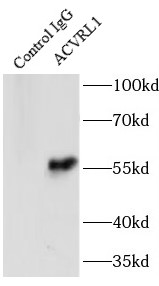      anti- ACVRL1 antibody