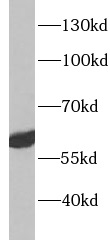 anti- ACVRL1 antibody