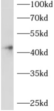      anti- ADAP2 antibody