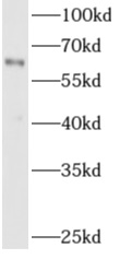      anti- ADAM8 antibody