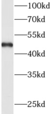      anti- ADAM5 antibody