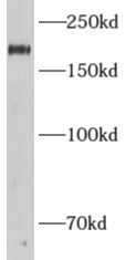      anti- ADCY3 antibody