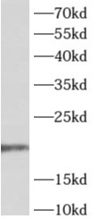      anti- ADAT2 antibody