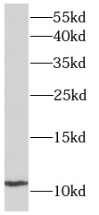      anti- ACYP2 antibody