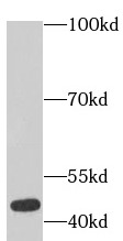      anti- ACTA2/smooth muscle actin antibody