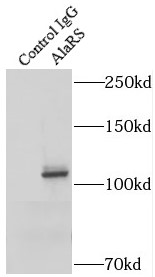      anti- AlaRS antibody