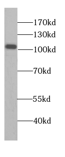      anti- AlaRS antibody