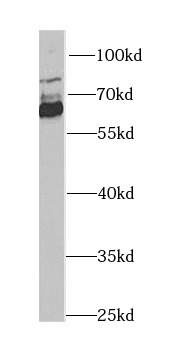      anti- ALDH4A1 antibody