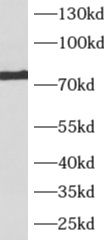      anti- AKAP10 antibody