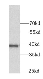      anti- AKR7A2 antibody