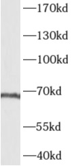      anti- AKNA antibody