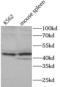      anti- AIM2 antibody