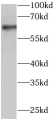      anti- AIRE antibody