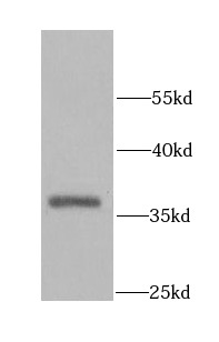      anti- AKTIP antibody